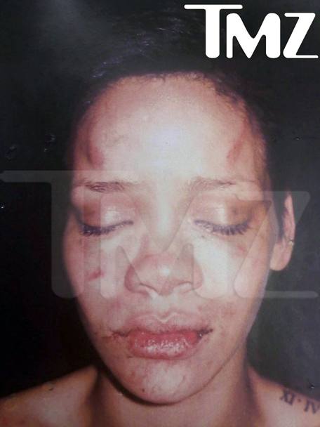 Rihanna, la star del pop che sub le percosse dall&#39;allora fidanzato Chris Brown. Nel 2009 le foto del suo viso tumefatto fecero il giro di tutti i siti e lui venne condannato a cinque anni di libert vigilata (Ap)